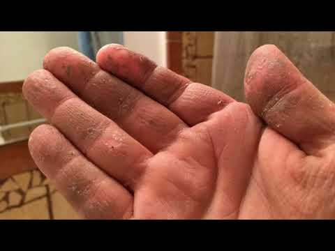 Can You Dissolve Super Glue