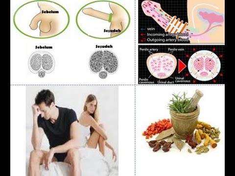 Bagaimana meningkatkan potensi 100 Bagaimana memuaskan seorang wanita penis kecil