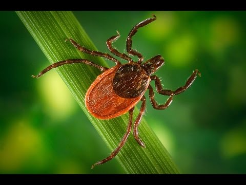 Planet Wissen - Zecken