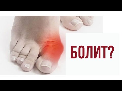 Могут ли при шейном остеохондрозе трястись руки Санаторий комплексное лечение позвоночника