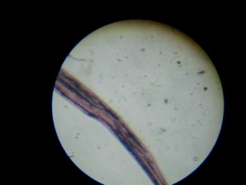 Széna bacillus parazita vagy saprotrof