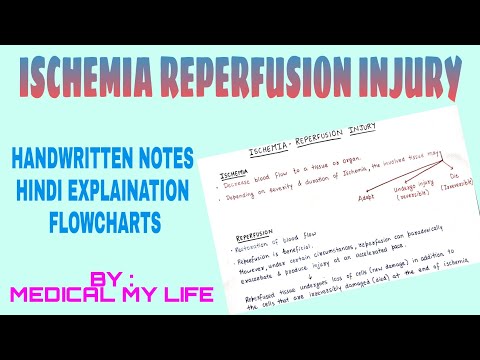 Ischemia Reperfusion Injury