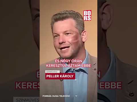 Súlyosan megégett Peller Károly arca #bors #pellerkaroly #baleset #szinesz #shrek