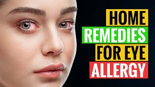 Effective Home Remedies for Eye Allergy | How to get relief from eye allergy