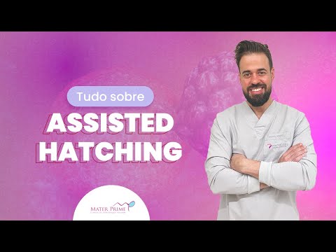 Reproduzir Vídeo