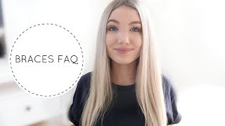 18 FAQ’S ABOUT MY BRACES | Kissing with braces, pain &amp; elastics!