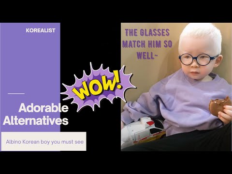 HAVE YOU seen albino Asian?