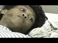 Filipino Film On Rabies