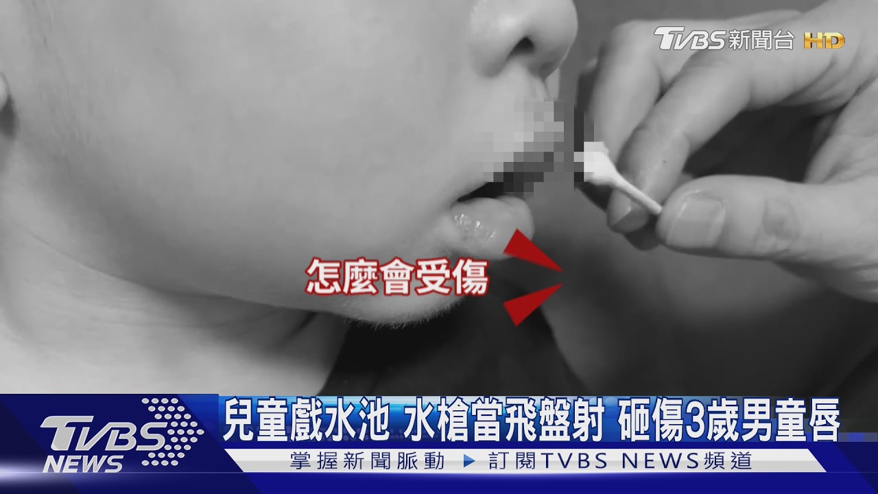 影音／兒童戲水池「水槍當飛盤射」！砸傷3歲男童唇　父抱兒求援控：沒人理