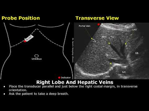 Positionierung der Ultraschallsonde für die Leber | Platzierung des Schallkopfes für die Leberunt...