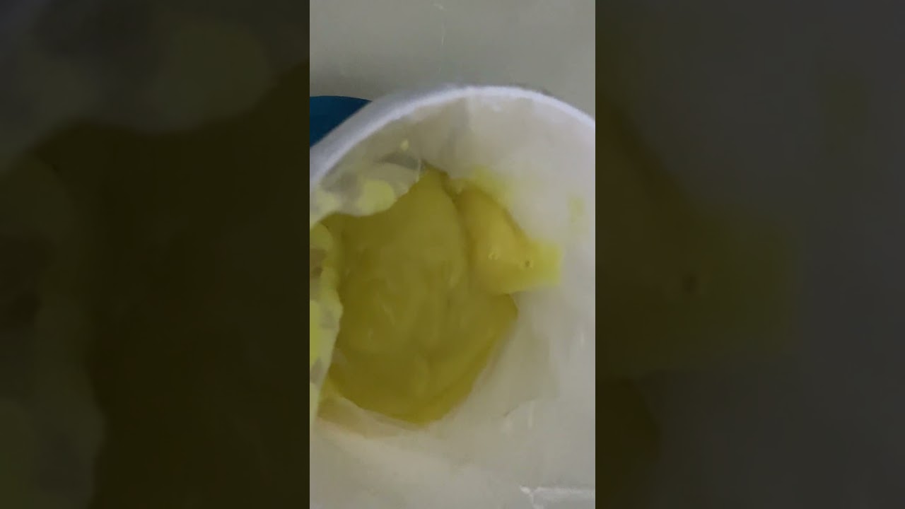 الغذاء الملكي احد منتجات الخلية انتاج 24+25🐝❤️