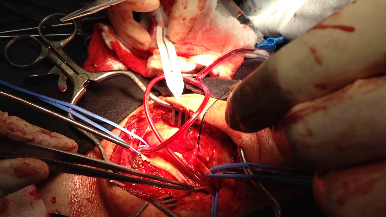 Ricardo Wagner Vasquez-32