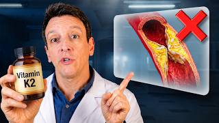 Vitamin K2 for Heart Health: Full Breakdown & Transcript