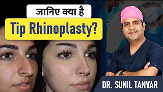 👉 Tip Rhinoplasty क्या है? नाक की Tip को Perfect Shape देने वाली Surgery |
