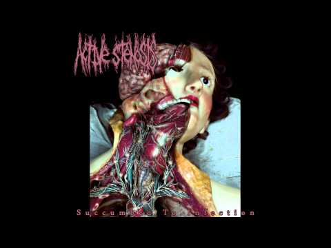 Active Stenosis ‎- Succumbed To Infection FULL ALBUM (2015 - Pathological Goregrind)