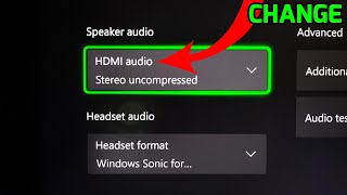 Xbox Series S CAN&#39;T Turn Off Speaker Audio? Here&#39;s how to FIX!
