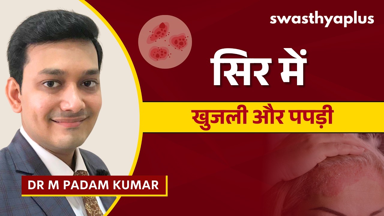 सेबोरिक डर्मेटाइटिस: कारण और इलाज | Seborrheic Dermatitis: How to Treat? | Dr M Pada