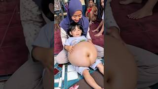 Download lagu Perut besar #shorts mp3