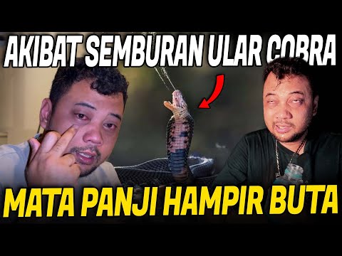 TUTORIAL: SURVIVE A COBRA SPREAD!! PANJI'S EYES RED, ALMOST BLINDED