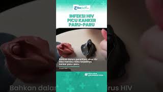 Waspadai Infeksi HIV Dapat Picu Kanker Paru-paru, Begini Cara Cegah yang Perlu Diketahui