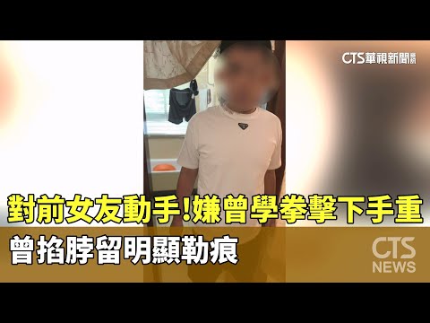 對前女友動手！　嫌曾學拳擊下手重　曾掐脖留明顯勒痕