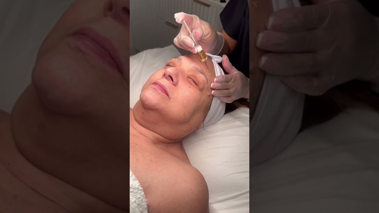 Treatment Video 2