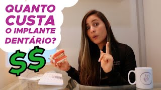 QUANTO CUSTA UM IMPLANTE DENTÁRIO
