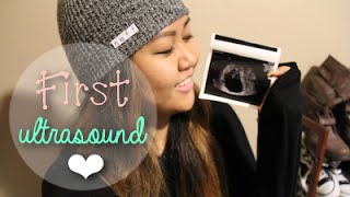 7 Weeks Pregnancy Vlog - First Ultrasound Reaction