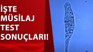 Müsilaj Test Sonuçları İlk Kez A Haber'de | A Haber