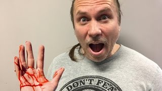 100 SNAKE BITES IN 10 MINUTES! | BRIAN BARCZYK