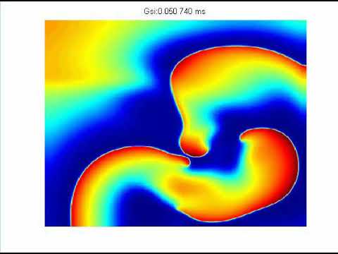 Simulation Modeling of 2D Spiral Waves