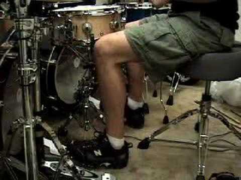 Bostic-Flat Foot Technique