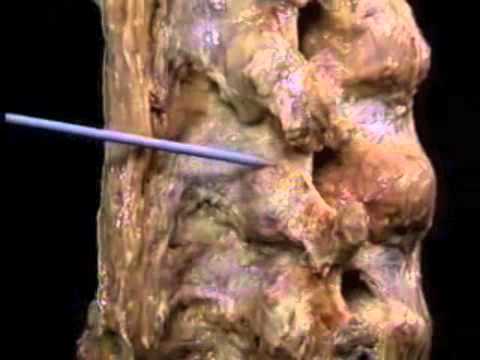Anatomia Coluna Vertebral 2º