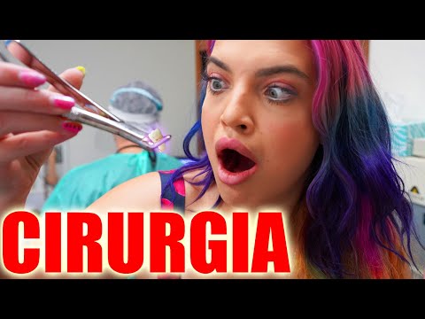 MINHA PRIMEIRA CIRURGIA - TIREI 4 DENTES DE UMA VEZ