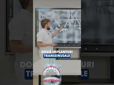 Domnul Mihai ți-a pus dantură fixă în 5 zile