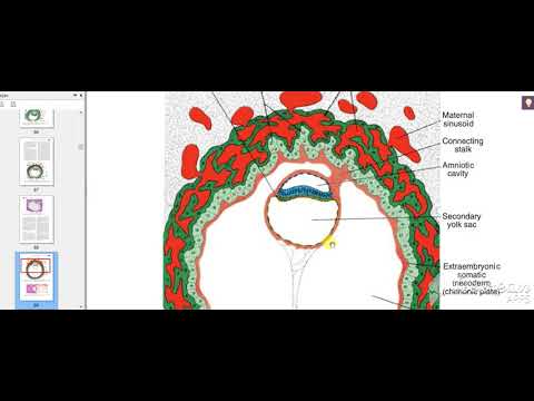 Extraembryonic mesoderm 4