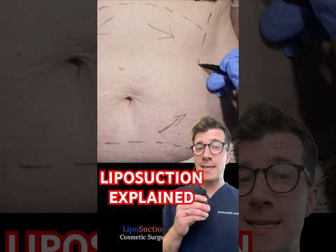 Liposuction Machine Ve
