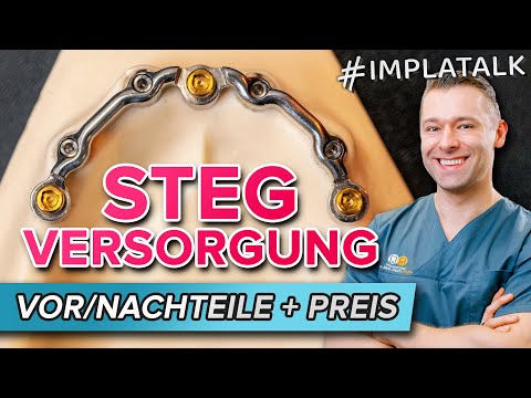 Implantatversorgung: Der Steg | Kombination mit Locatoren für festen Halt!