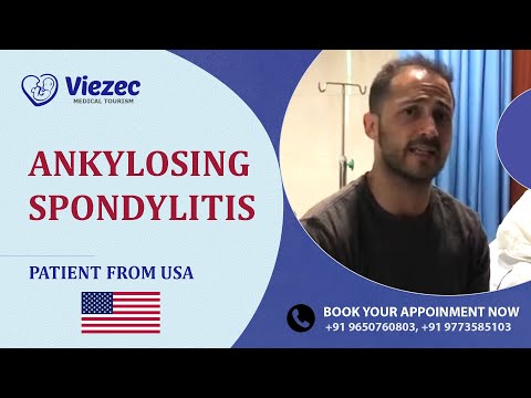 Stem Cell Treatment For Ankylosing Spondylitis