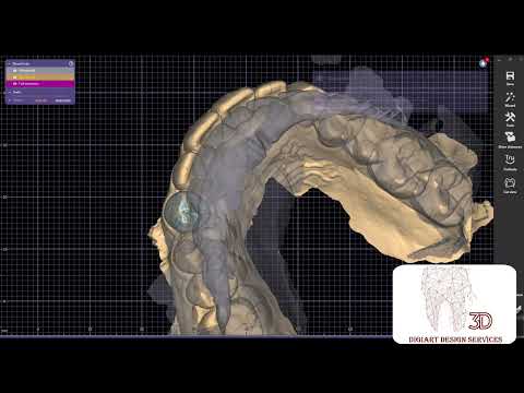 Exocad Tutorial : Eggshell Restorations using Exocad