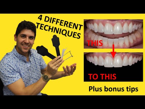 How To Get A Black Background For Dental Photography (With/Without Dental Contrasters) FOR BEGINNERS