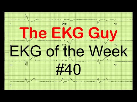 EKG / ECG of the Week #40 l The EKG Guy - www.ekg.md