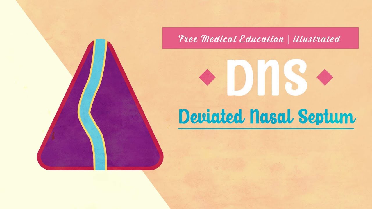 What is Deviated Nasal Septum (DNS)? - YouTube