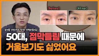 망한 쌍수, 5번째 수술 끝에 드디어 성공!