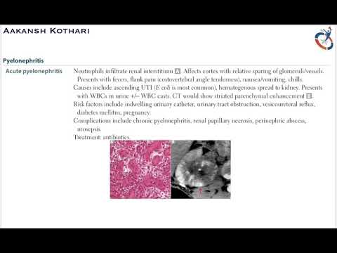 Mediquest ( Entry No 46 ) || UTI by AAKANSH KOTHARI