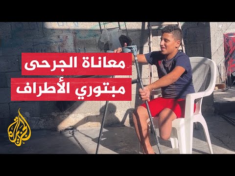 فيديو | وزارة الصحة في غزة تحذر من تفاقم أوضاع الجرحى مبتوري الأطراف وضرورة التدخل الدولي
