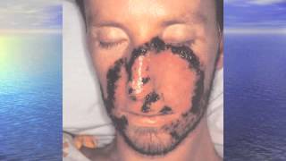 Tropical Infections Review -- John Greene, MD