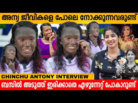 അന്യ ജീവികളെ പോലെ നോക്കുന്നവരുണ്ട്😪 CHINCHU ANTONY INTERVIEW | VARIETY MEDIA