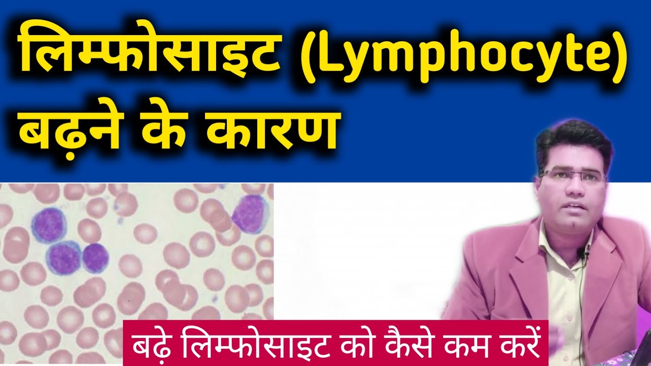 What are The Causes of Lymphocytosis - & How to Reduce it (Lymphocyte High Range)