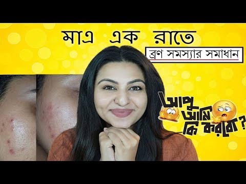 এক রাতেই ব্রণের সমস্যার সমাধান | How to Remove Pimples Overnight | Bangladesh || Ananya Artistry Video
